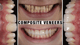 Slider image (8) CHC Clinica Dental in Barcelona Spain